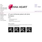 Patients history
